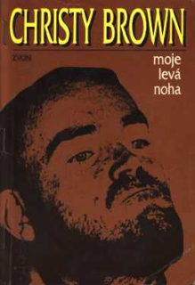 MOJE LEVÁ NOHA